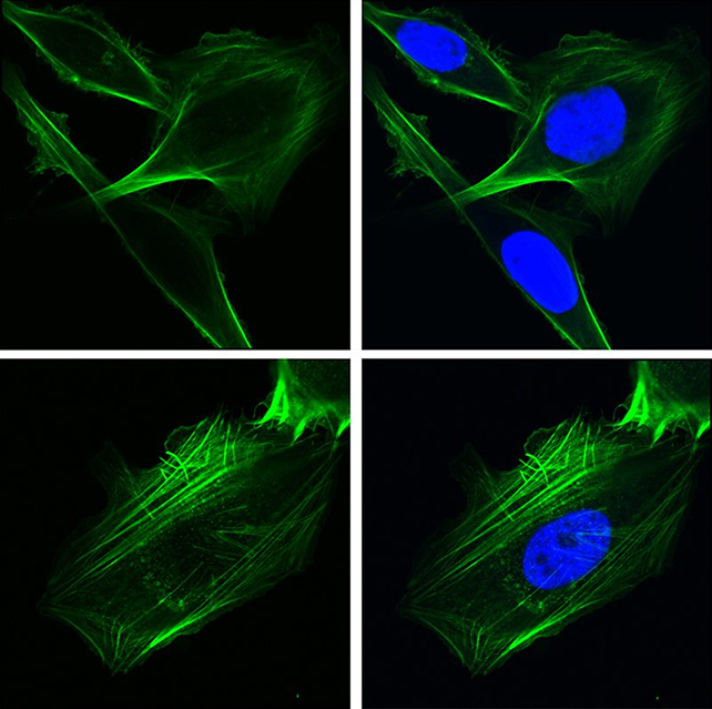 Cells with (top row) and without (bottom row) GRP78 – blue shows the nucleus, green shows cytoskeletal protein. (Ze Liu/Amy Lee)